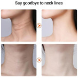 جهاز تجميل الرقبة وإزالة التجاعيد IPL Wrinkle Neck Beauty Device جهاز تجميل الرقبة وإزالة التجاعيد IPL Wrinkle Neck Beauty Device