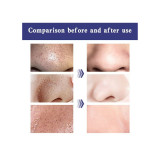 شرائط تنظيف المسام العميق للأنف بالفحم Lift & Firm Original Deep Cleansing Pore Strips شرائط تنظيف المسام العميق للأنف بالفحم Lift & Firm Original Deep Cleansing Pore Strips